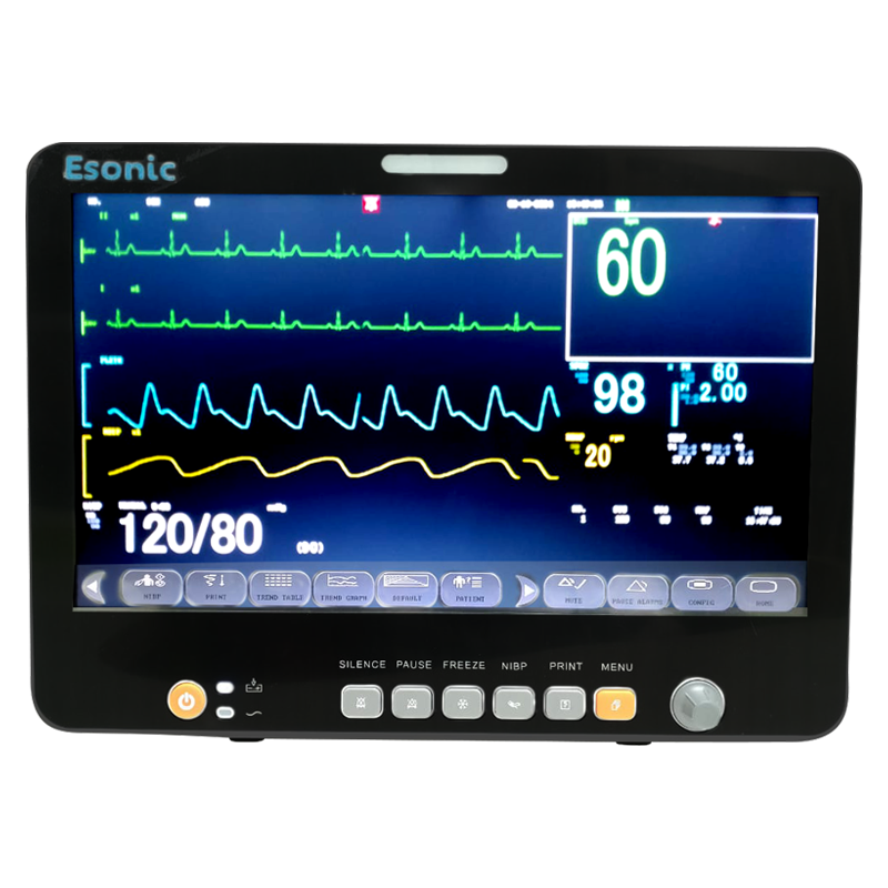 Multi Parameter Patient Monitor